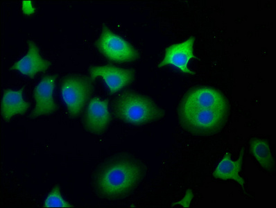 Anti-SNF8 Antibody