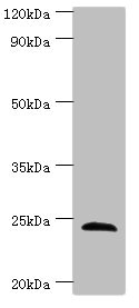 Anti-SOST Antibody
