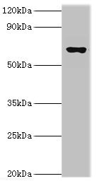 Anti-GAD1 Antibody