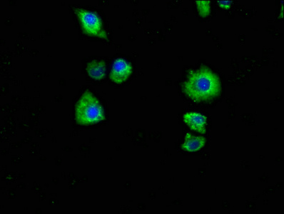 Anti-P2RX7 Antibody
