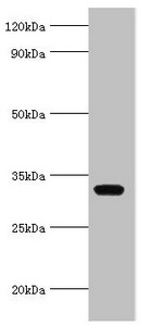 Anti-AGPAT1 Antibody