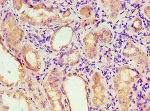 Anti-AGPAT1 Antibody