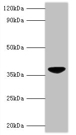 Anti-VP3 Antibody