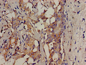 Anti-SRMS Antibody