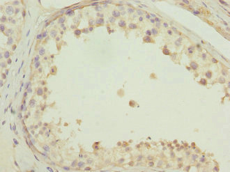 Anti-EVA1A Antibody