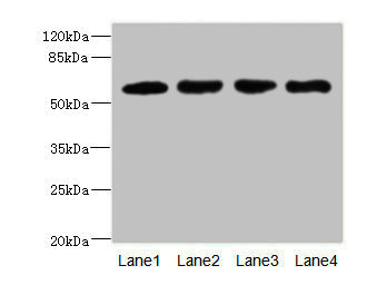Anti-IL21R Antibody