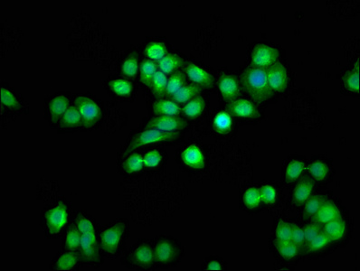 Anti-SSU72 Antibody
