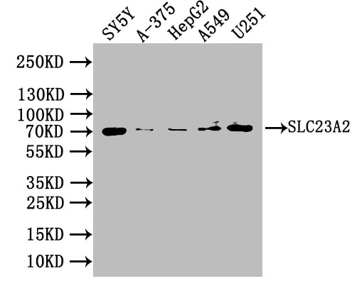 Anti-SLC23A2 Antibody