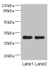 Anti-DRAM2 Antibody