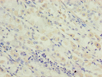 Anti-OXSM Antibody