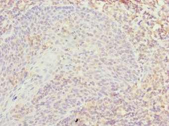 Anti-TXNL4B Antibody