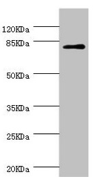 Anti-DPP3 Antibody