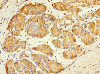 Anti-MESP1 Antibody
