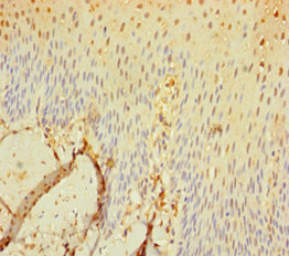 Anti-SEC11C Antibody