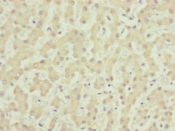 Anti-NUF2 Antibody