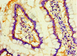 Anti-MOB1A Antibody