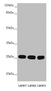 Anti-CHCHD3 Antibody