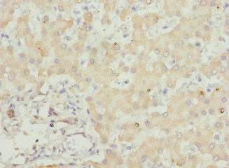 Anti-USP26 Antibody