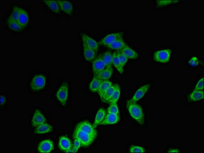 Anti-MS4A6A Antibody