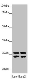Anti-GRPEL1 Antibody