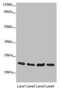 Anti-RAB18 Antibody