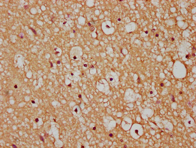Anti-HACD3 Antibody