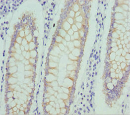Anti-NUAK2 Antibody