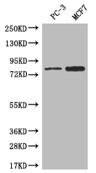 Anti-LRRN3 Antibody