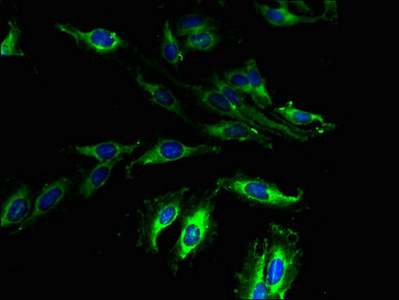 Anti-GPR173 Antibody
