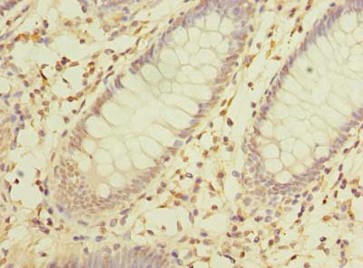Anti-MRPL16 Antibody