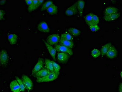 Anti-MAT2B Antibody