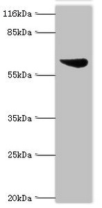 Anti-ASH2L Antibody