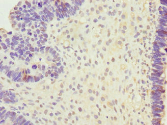 Anti-SAP30BP Antibody