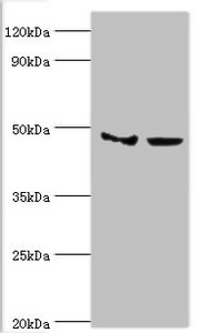 Anti-SMYD3 Antibody