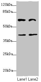 Anti-DCP1A Antibody