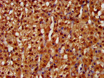Anti-LARP6 Antibody
