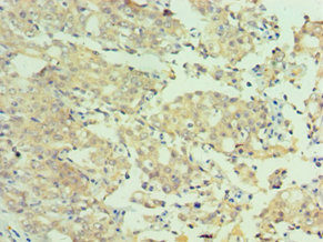 Anti-MTMR4 Antibody