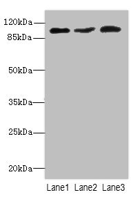 Anti-DDX20 Antibody