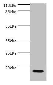 Anti-JPT1 Antibody