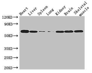 Anti-TBX21 Antibody