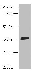 Anti-DHDH Antibody