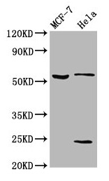 Anti-SLC45A2 Antibody