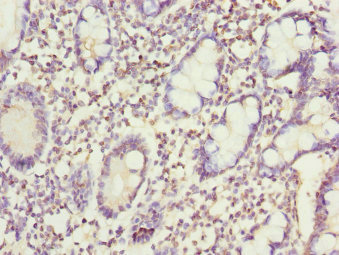 Anti-SNX7 Antibody
