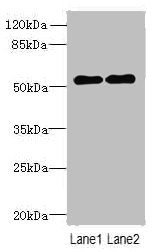 Anti-TRMT6 Antibody