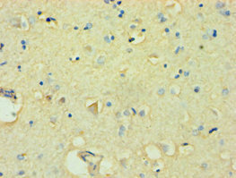 Anti-FBXW11 Antibody