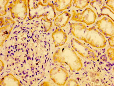 Anti-AGO2 Antibody