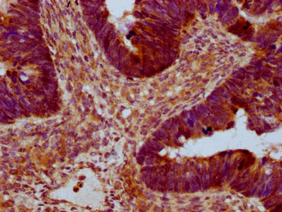 Anti-RAB21 Antibody