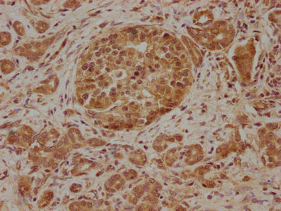 Anti-SLC39A10 Antibody