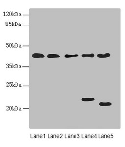 Anti-LHX6 Antibody