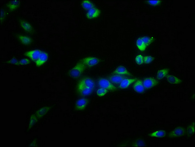 Anti-FBXL2 Antibody